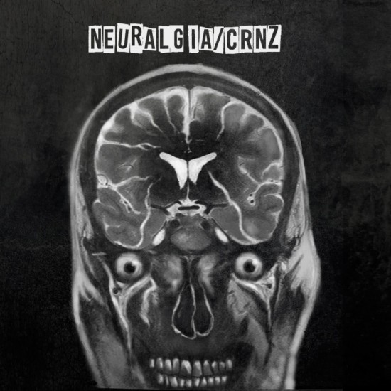 CRNZ - Neuralgia